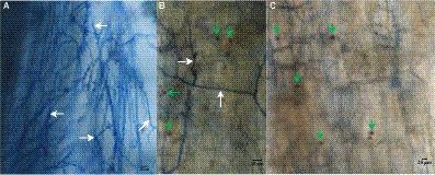 Colonization of root endophytic fungus Serendipita indica improves drought tolerance of Pinus taeda seedlings by regulating metabolome and proteome